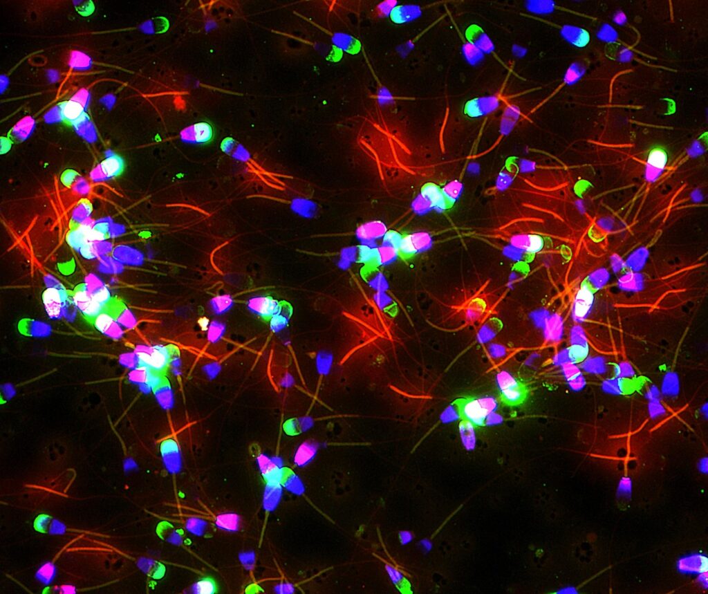 Fluorescent microscopy image showing sperm heads at 400x magnification, symbolizing intimacy and biological connection.